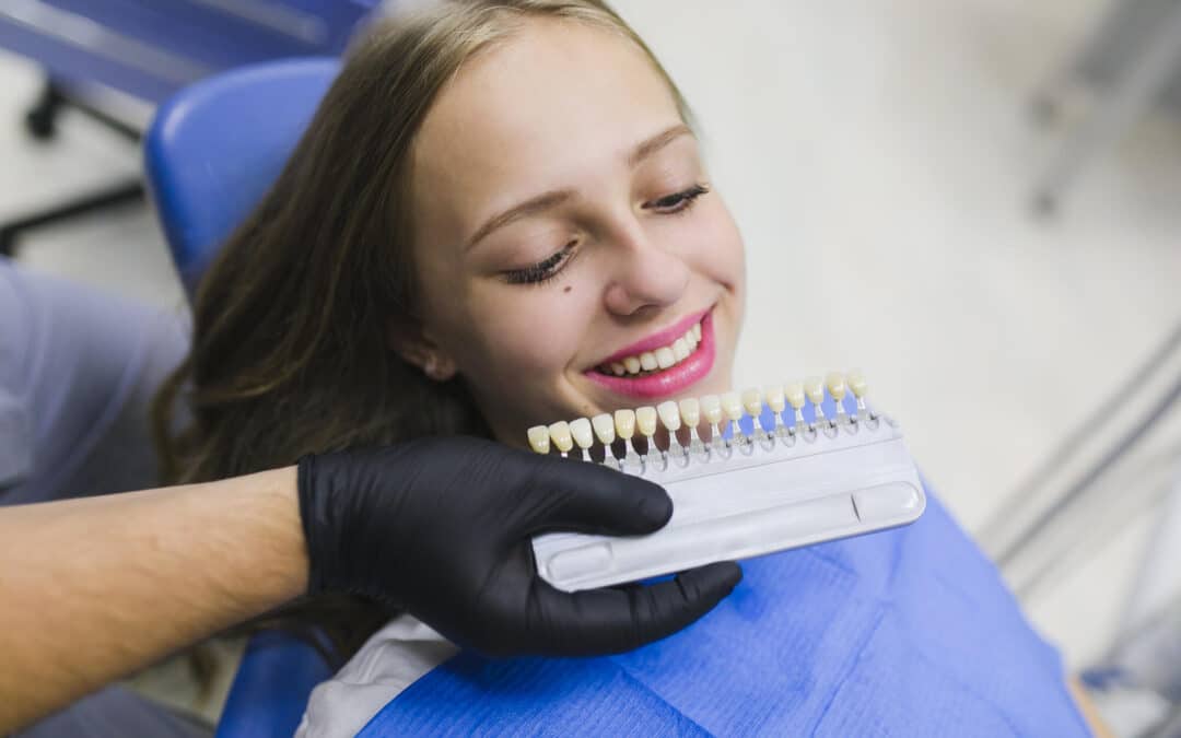 Veneers Lexington Ky