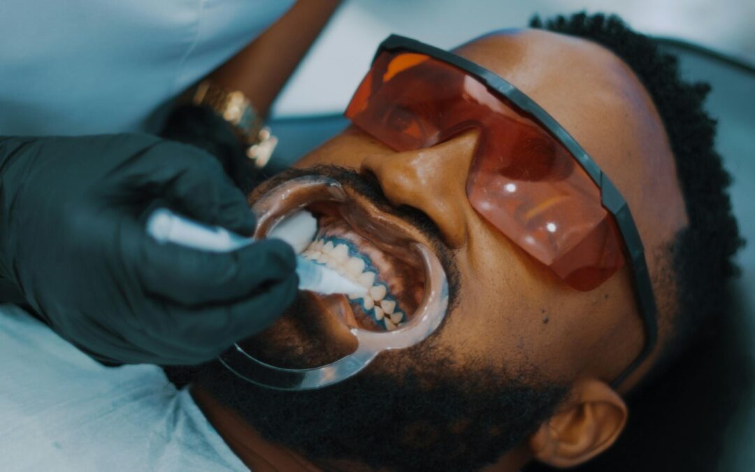 Achieve a Radiant Smile with Professional Teeth Whitening